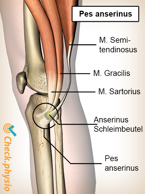 Kniesehnen Pes Anserinussyndrom | Ursache, Symptome & Behandlung