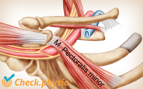 Schulter Arm Hand TOS Thoracic Outlet Syndrom Pectoralis minor